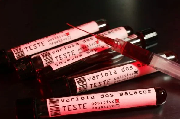 Read more about the article Varíola dos macacos: ministro da Saúde anuncia compra de antiviral